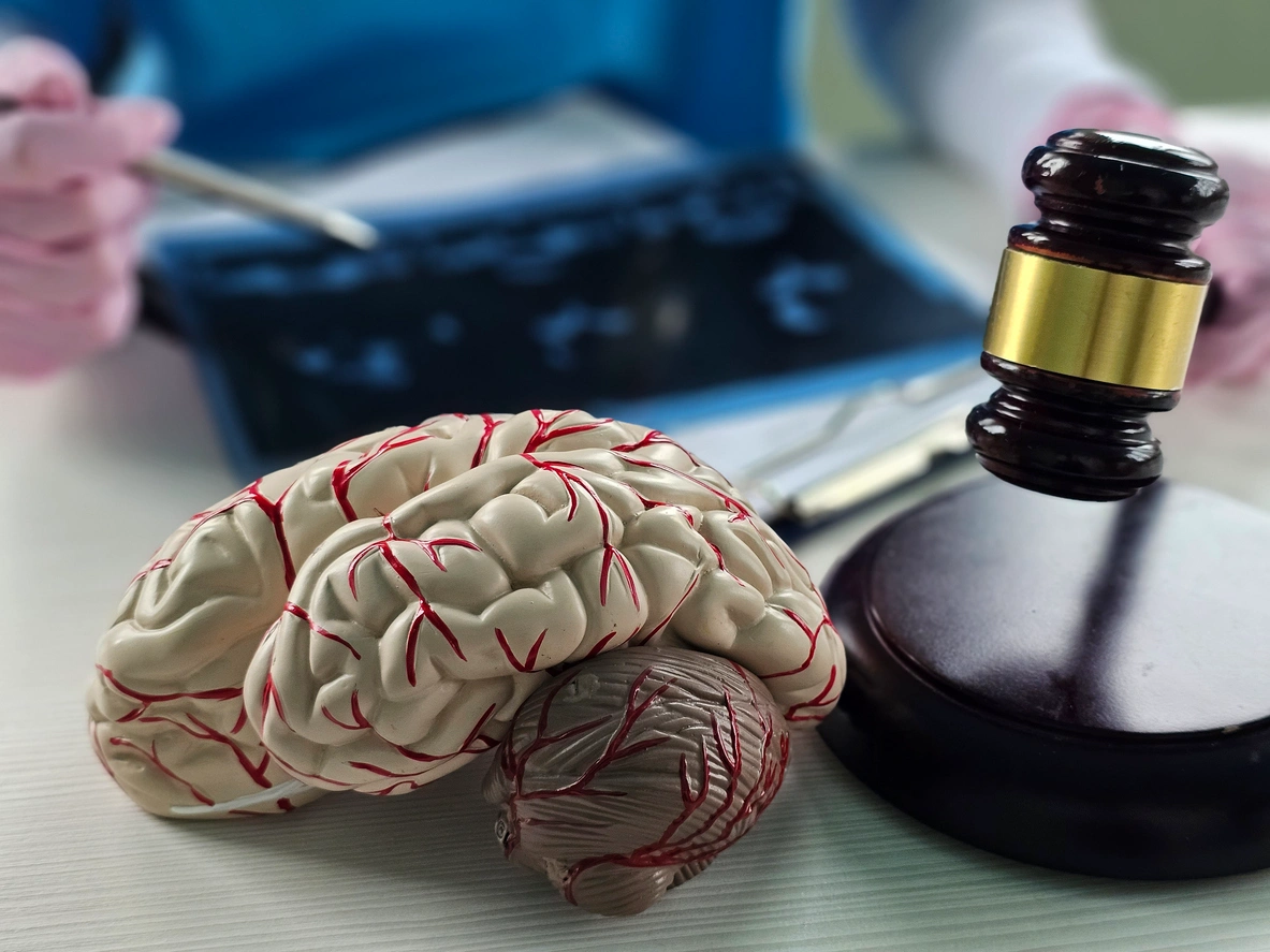 Future Medical Costs In 2026 And The Role Of Charlotte Brain Injury Attorneys In TbI Valuation